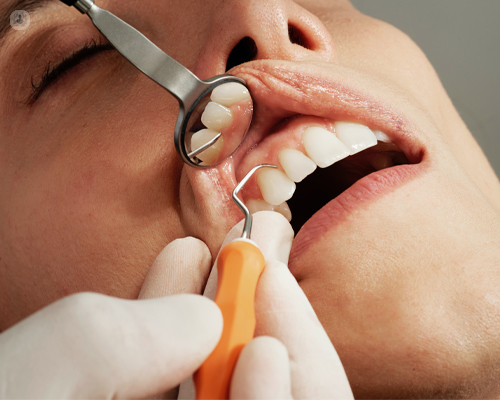 Gum abscesses and gum boils: symptoms, causes, treatment