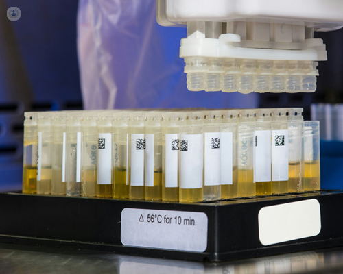 Urine sample ready for paracetamol analysis 