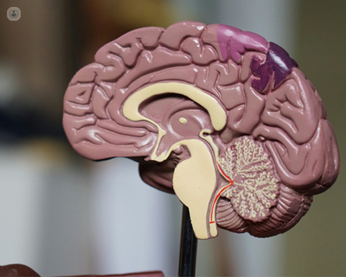 Model of the brain, which can be affected by cerebral small vessel disease